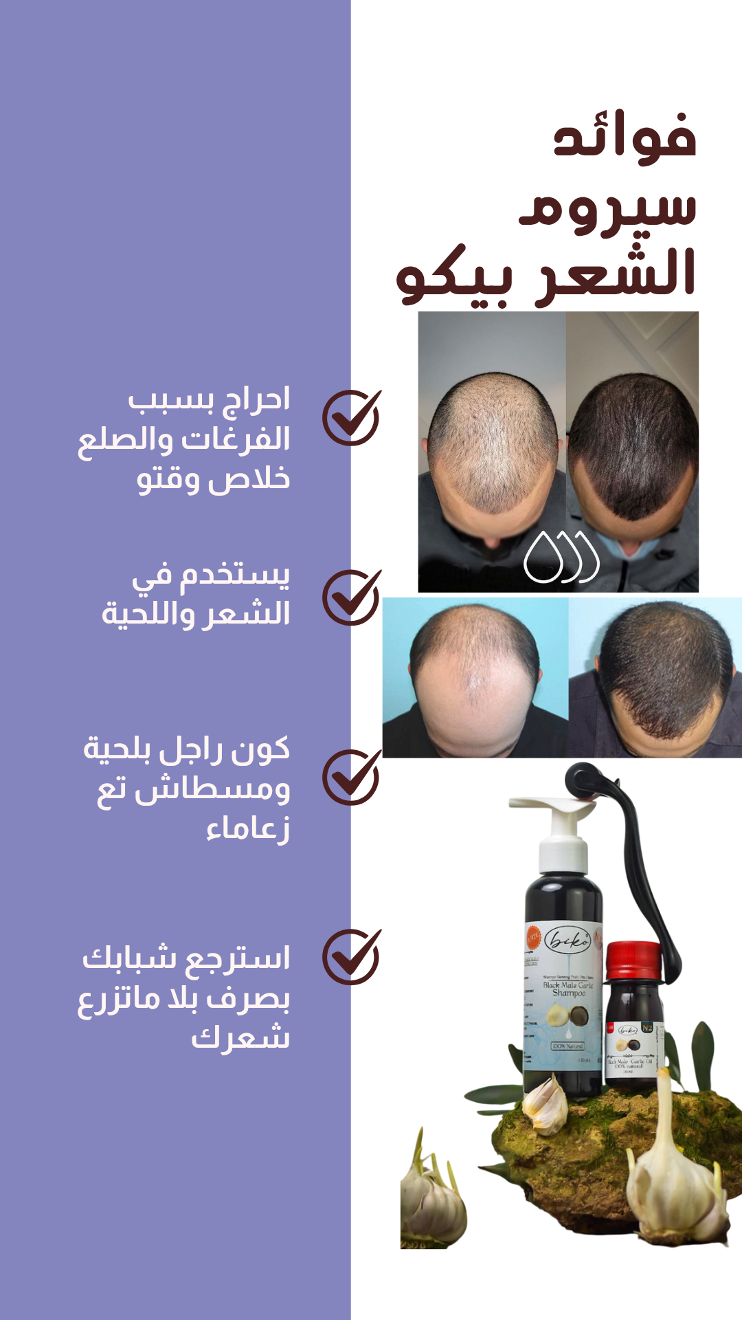 شامبو وزيت ذكر الثوم الأسود biko - Image 4